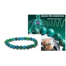 Chrysocolla against diabetes, elastic bracelet, ball 8 mm / 16-17 cm, King Solomon stone